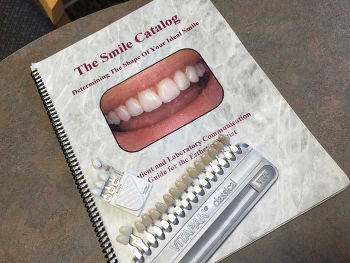 Book on Dental Veneers